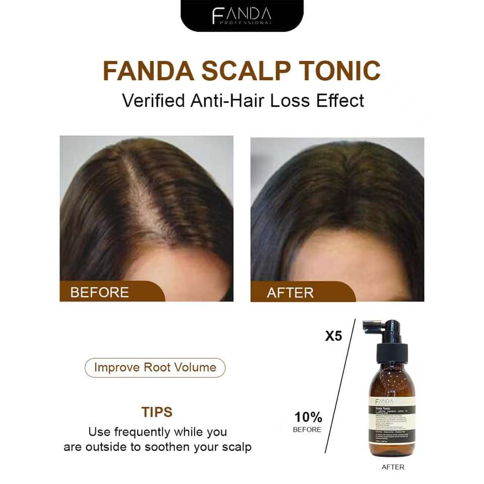 Fanda Scalp Tonic (100ml)