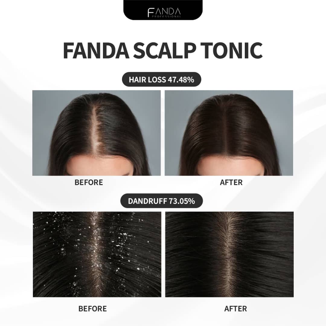 Fanda Scalp Tonic (100ml)