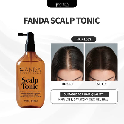 Fanda Scalp Tonic (100ml)
